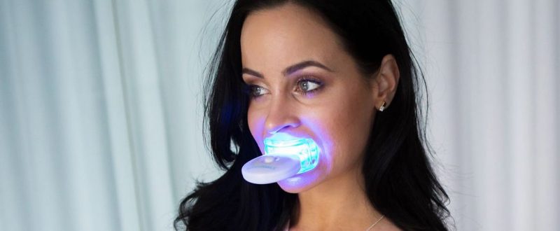 The Vanity Vault - How To Safely Brighten Your Teeth in 2022 - Cover